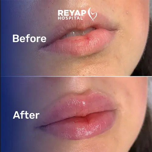 Reyap Hospital Medical Dermatology Before/After Image
